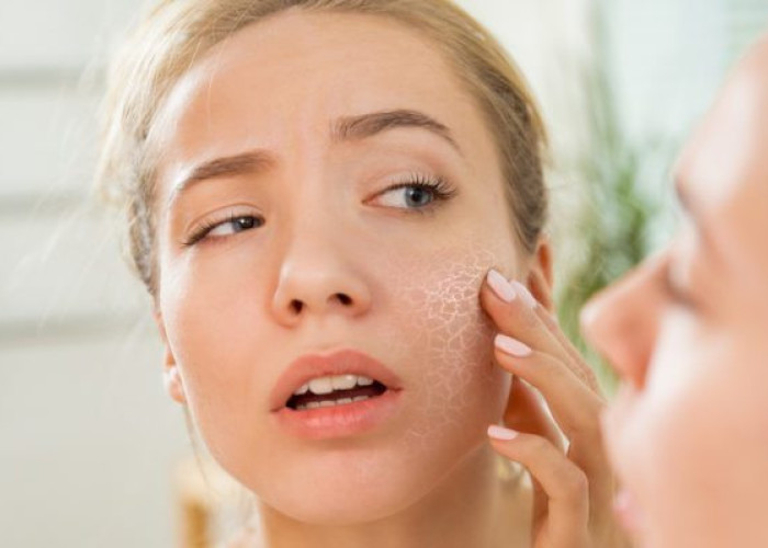 Τροφικές δυσανεξίες: Αυτό το σημάδι στο πρόσωπο ίσως δείχνει πρόβλημα με αυτά που τρώτε.