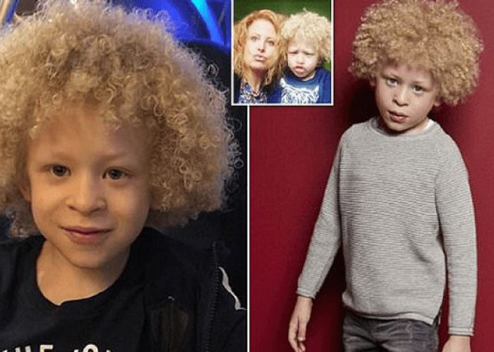 Αγοράκι 5 χρονών με αλμπινισμό έγινε μοντέλο σε γνωστή εταιρεία ρούχων χάρη σε μια φωτογραφία που ανέβασε η μαμά του στο Facebook