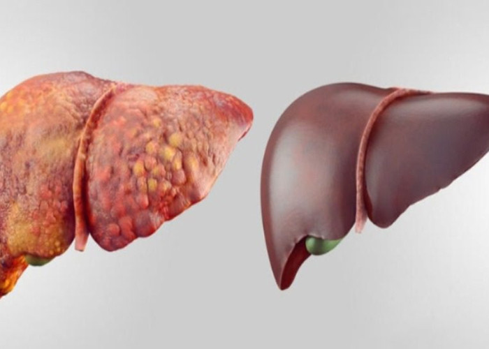 ΚΑΘΑΡΙΣΤΕ ΤΟ ΣΥΚΩΤΙ ΣΑΣ ΜΕ 6 ΦΥΣΙΚΟΥΣ ΚΑΙ ΑΝΩΔΥΝΟΥΣ ΤΡΟΠΟΥΣ-ΣΩΖΕΙ ΖΩΕΣ!