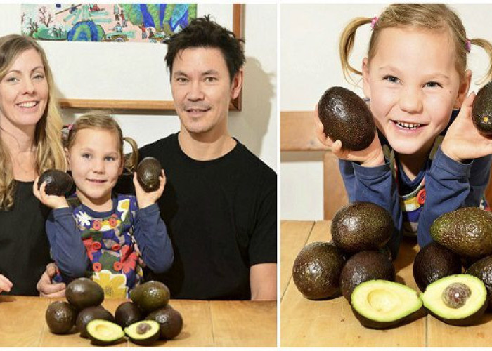 5ΧΡΟΝΟ ΚΟΡΙΤΣΙ ΠΟΥ ΕΠΑΣΧΕ ΑΠΟ ΕΠΙΛΗΠΤΙΚΕΣ ΚΡΙΣΕΙΣ ΘΕΡΑΠΕΥΤΗΚΕ ΟΤΑΝ ΕΦΑΓΕ ΧΙΛΙΑΔΕΣ ΑΒΟΚΑΝΤΟ!