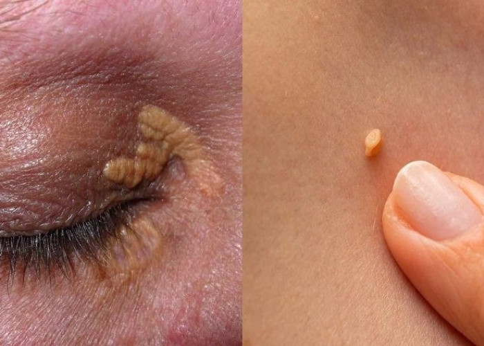 Σημάδια στο δέρμα: 10 “αθώα” συμπτώματα στην επιδερμίδα δείχνουν πως κάτι δεν πάει καλά με την υγεία μας