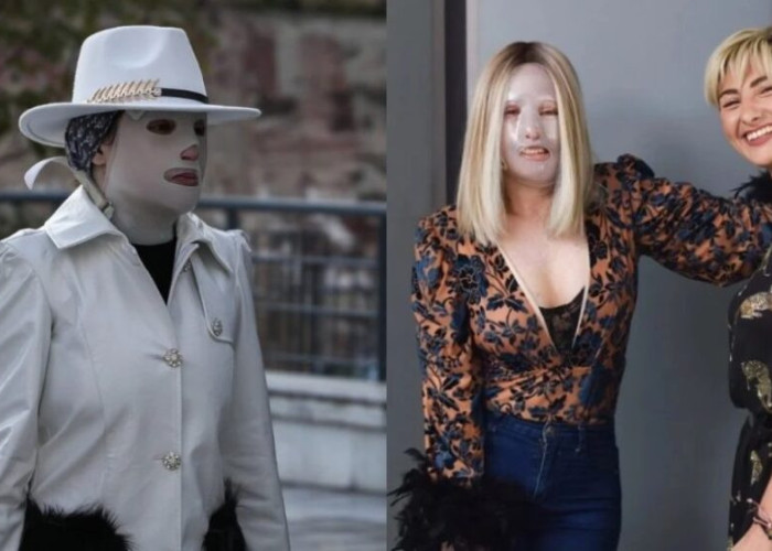 Ρεγγίνα Μακέδου σε Ιωάννα Παλιοσπύρου: «Ούτε η λευχαιμία, ούτε ο διαβήτης πρέπει να είναι ταμπού»