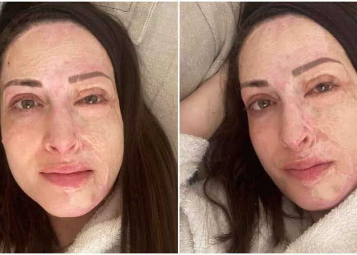 «Ακόμα παλεύω να αποδεχτώ τον νέο μου εαυτό»: Ραγίζει καρδιές η Ιωάννα Παλιοσπύρου χωρίς ίχνος μακιγιάζ