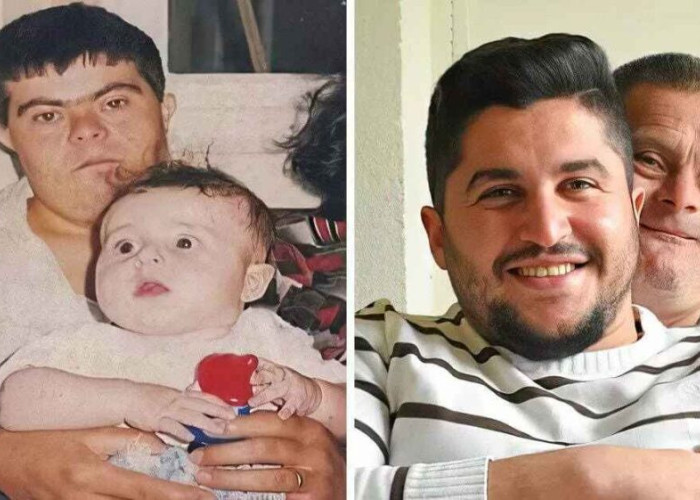 Πατέρας με σύνδρομο Down συστήνει το γιο του που έγινε γιατρός