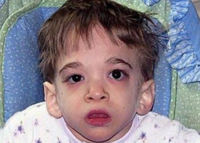 Η Ασθένεια Του Έχει Σοκάρει Τους Γιατρούς Παγκοσμίως. Μόλις Μάθετε ΠΟΣΟ Χρονών Είναι, Θα Σας Πέσει Το Σαγόνι!