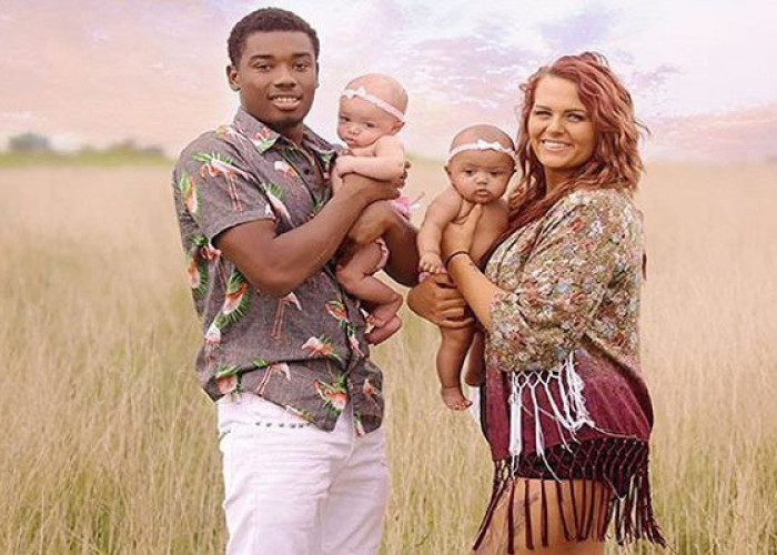 Τα δίδυμα που νικάνε το ρατσισμό