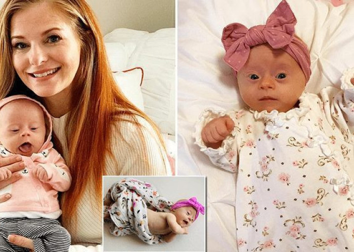 Μητέρα στενοχωρήθηκε όταν έμαθε ότι περιμένει μωρό με σύνδρομο Down αλλά τώρα δε ζει στιγμή χωρίς την κορούλα της