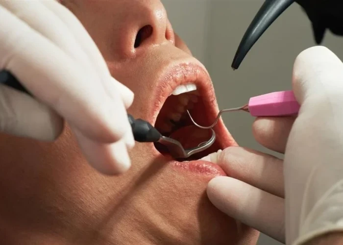 Γαλλία: Οδοντίατρος δεν αποστείρωνε τα εργαλεία – Τρέχουν για εξετάσεις AIDS και ηπατίτιδας