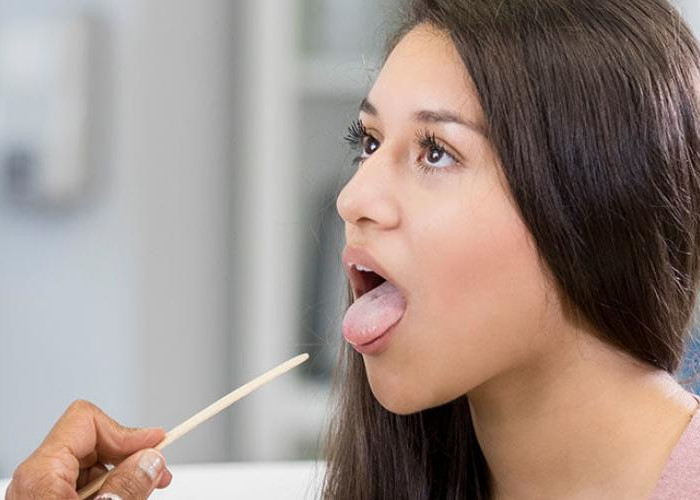 Κορωνοϊός: Πώς φαίνεται σε στόμα, γεύση, γλώσσα – Τα 4 ύποπτα συμπτώματα (ΦΩΤΟ)