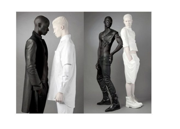 Nέοι με αλμπινισμό που τους κορόιδευαν για την εμφάνισή τους, έγιναν μοντέλα και έσπασαν κάθε στερεότυπο