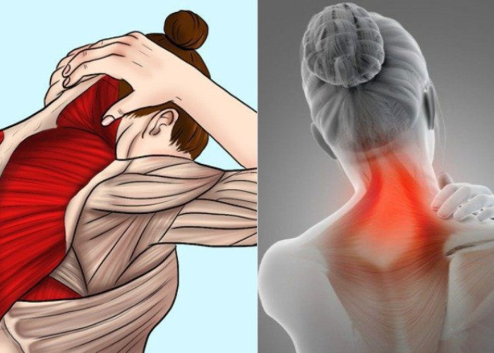 Αυχενικό σύνδρομο: Ποιες οι αίτιες – Ποια τα ανησυχητικά συμπτώματα – Πως να το αντιμετωπίσετε