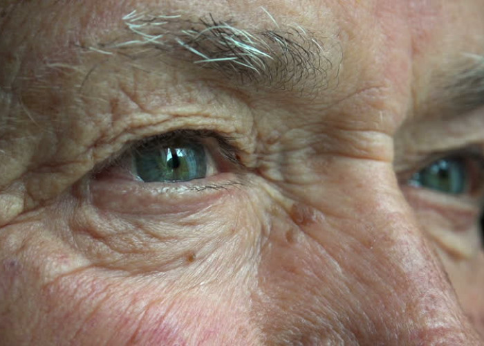 Άνοια – Ποιες παθήσεις του ματιού συνδέονται με την εμφάνισή της
