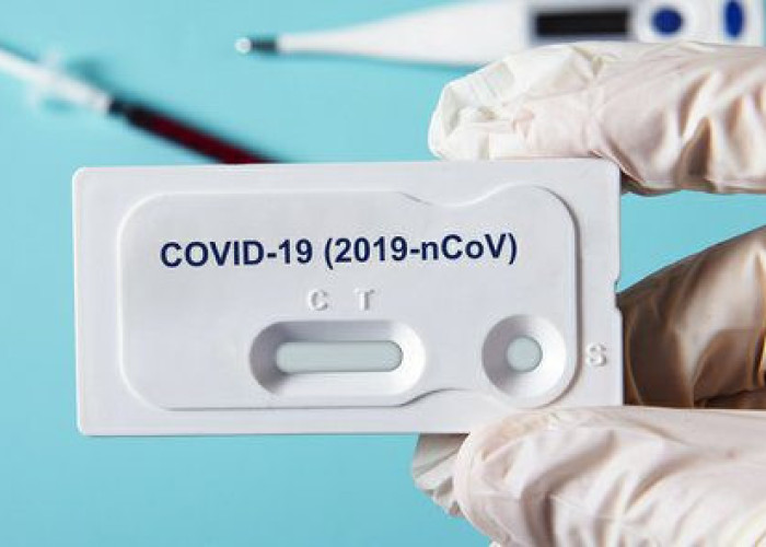 Self test: Tι αλλάζει από σήμερα για τους εργαζόμενους