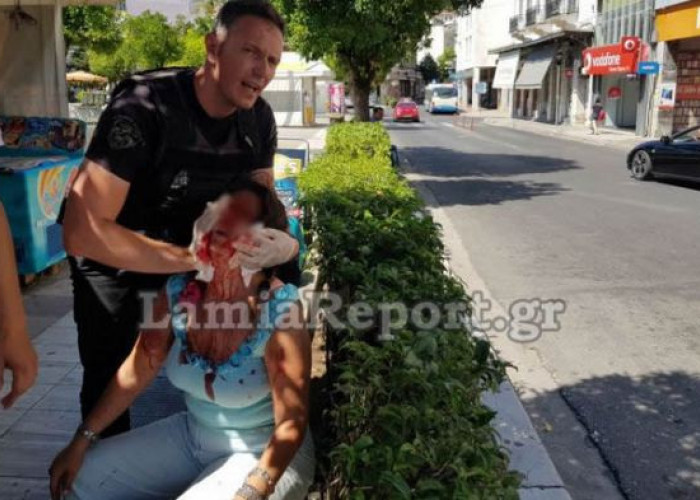 «Βοήθεια θα με σκοτώσει» – Άγριος ξυλοδαρμός μητέρας από τον σύντροφό της στη μέση του δρόμου