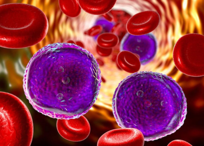 Καρκίνος: Ασθενείς με λευχαιμία θεραπεύτηκαν για πάνω από δέκα χρόνια χάρη στην ανοσοθεραπεία CAR-T