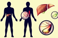 ΠΕΤΡΕΣ ΣΤΗN ΧΟΛΗ: ΣΥΜΠΤΩΜΑΤΑ, ΑΝΤΙΜΕΤΩΠΙΣΗ ΚΑΙ ΠΡΟΛΗΨΗ!