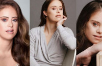 ΠΡΩΤΑΘΛΗΤΡΙΑ ΕΝΟΡΓΑΝΗΣ ΜΕ ΣΥΝΔΡΟΜΟ DOWN ΓΙΝΕΤΑΙ ΜΟΝΤΕΛΟ ΚΑΙ ΕΜΠΝΕΕΙ ΚΑΘΕ ΓΥΝΑΙΚΑ!