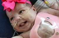 Το μωράκι που γεννήθηκε με την καρδιά έξω από το σώμα του τα κατάφερε και επιστρέφει στο σπίτι της!