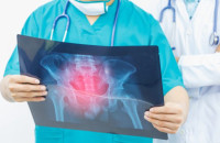 Καρκίνος – συμπτώματα: Μην αμελήσετε ποτέ αυτά τα 5 “ανύποπτα” σημάδια!