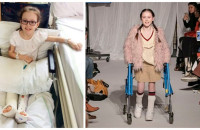 11χρονη με εγκεφαλική παράλυση περπάτησε στην πασαρέλα χωρίς αναπηρικό καροτσάκι και συγκίνησε τους πάντες!