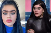 Με άλλα χείλη – μύτη, χωρίς έντονα ζυγωματικά: Διέρρευσε φώτο της Χατζηπαντελή πριν τις πλαστικές