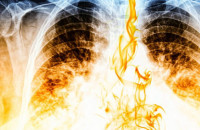 Σε πόσο καιρό θα καθαρίσουν οι πνεύμονες, αν κόψετε σήμερα το κάπνισμα!!!