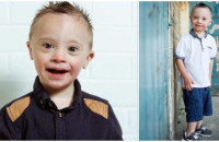 Αγοράκι με Σύνδρομο Down έγινε μοντέλο και κάνει τους πάντες να «λιώνουν» με το χαμόγελό του!