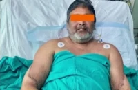 Ινδία: Άνδρας έχει πλέον γυναικεία χέρια ύστερα από σπάνια διπλή μεταμόσχευση