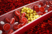 Το πρώτο βήμα για χαμηλότερη χοληστερίνη: Τι προτείνουν οι καρδιολόγοι