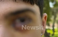 Ξυλοδαρμός στα Ιωάννινα: 17 ράμματα στο μάτι έκανε ο 16χρονος – «Τον χτύπησαν με μίσος, έχει υποστεί βλάβη»