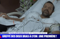 Μεταμόσχευση χεριών από το ύψος του ώμου για πρώτη φορά στα χρονικά! Πρόκειται για ηλεκτρολόγο που είχε χτυπηθεί από 11.000 βολτ και ακρωτηριάστηκε…