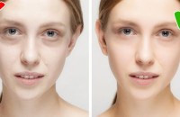 Τα 6 συμπτώματα που φανερώνουν ότι έχετε έλλειψη σιδήρου