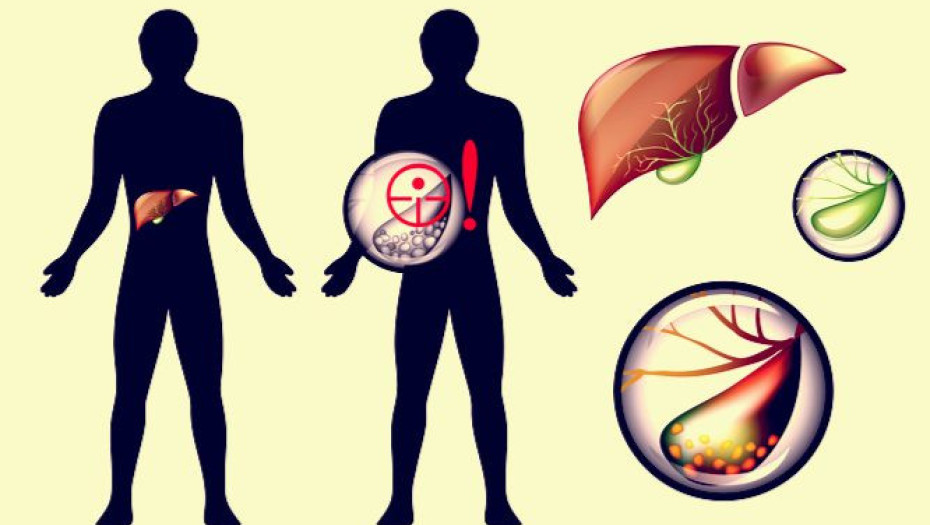 ΠΕΤΡΕΣ ΣΤΗN ΧΟΛΗ: ΣΥΜΠΤΩΜΑΤΑ, ΑΝΤΙΜΕΤΩΠΙΣΗ ΚΑΙ ΠΡΟΛΗΨΗ!