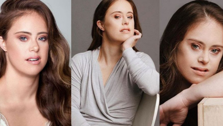 ΠΡΩΤΑΘΛΗΤΡΙΑ ΕΝΟΡΓΑΝΗΣ ΜΕ ΣΥΝΔΡΟΜΟ DOWN ΓΙΝΕΤΑΙ ΜΟΝΤΕΛΟ ΚΑΙ ΕΜΠΝΕΕΙ ΚΑΘΕ ΓΥΝΑΙΚΑ!