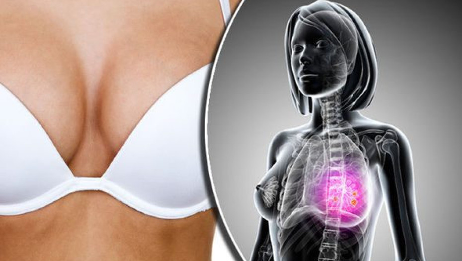 Καρκίνος του μαστού – Συμπτώματα: 9 προειδοποιητικά σημάδια