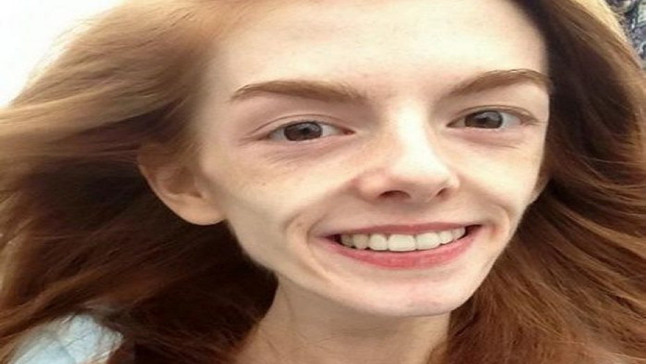 ΕΚΠΛΗΚΤΙΚΗ ΜΕΤΑΜΟΡΦΩΣΗ: ΑΝΟΡΕΞΙΚΗ ΠΟΥ ΖΥΓΙΖΕ 30 ΚΙΛΑ ΣΩΘΗΚΕ ΑΠΟ ΤΗ ΣΟΚΟΛΑΤΑ!