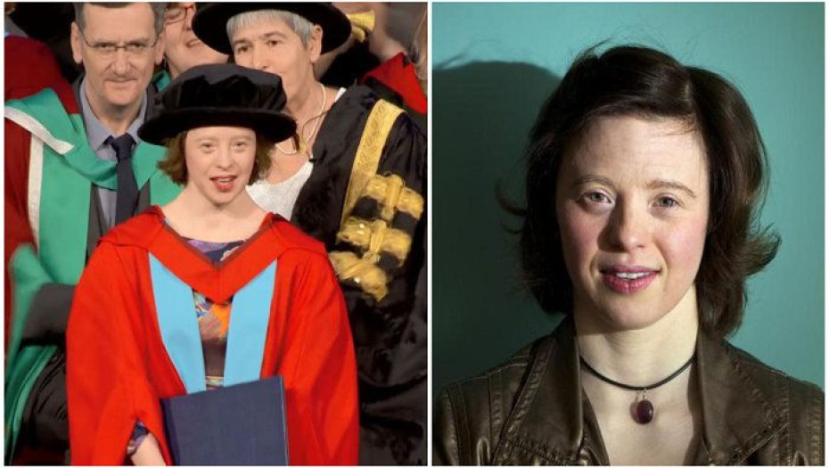 KOΠΕΛΑ ΓΕΝΝΗΘΗΚΕ ΜΕ ΣΥΝΔΡΟΜΟ DOWN, AΠΟΦΟΙΤΗΣΕ ΑΠΟ ΤΗ ΝΟΜΙΚΗ ΚΑΙ ΣΤΕΛΝΕΙ ΤΟ ΠΙΟ ΔΥΝΑΤΟ ΜΗΝΥΜΑ ΕΛΠΙΔΑΣ!