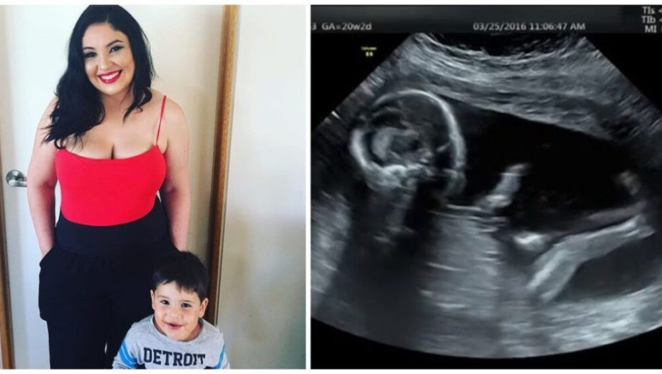 4χρονος θυμάται την αποβολή που είχε η μητέρα του πριν γεννήσει και λέει πως πέθανε και επέστρεψε στη ζωή!!!