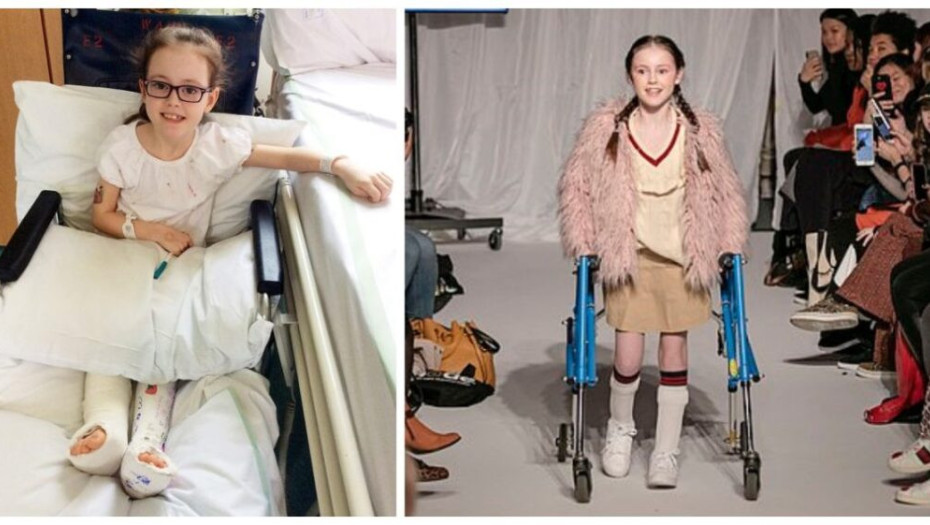 11χρονη με εγκεφαλική παράλυση περπάτησε στην πασαρέλα χωρίς αναπηρικό καροτσάκι και συγκίνησε τους πάντες!