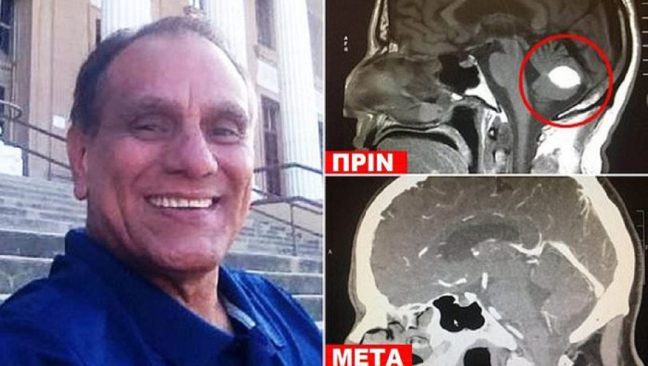 ANΤΡΑΣ ΜΕ ΚΑΡΚΙΝΟ «ΚΕΡΔΙΣΕ» ΤΟΝ ΟΓΚΟ ΣΤΟ ΚΕΦΑΛΙ ΜΕ ΠΡΟΣΕΥΧΗ ΣΤΟ ΘΕΟ ΚΑΙ ΟΙ ΓΙΑΤΡΟΙ «ΣΚΙΖΟΥΝ ΤΑ ΠΤΥΧΙΑ ΤΟΥΣ»