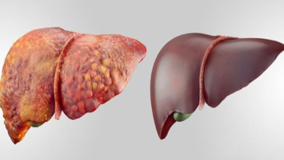 ΚΑΘΑΡΙΣΤΕ ΤΟ ΣΥΚΩΤΙ ΣΑΣ ΜΕ 6 ΦΥΣΙΚΟΥΣ ΚΑΙ ΑΝΩΔΥΝΟΥΣ ΤΡΟΠΟΥΣ-ΣΩΖΕΙ ΖΩΕΣ!