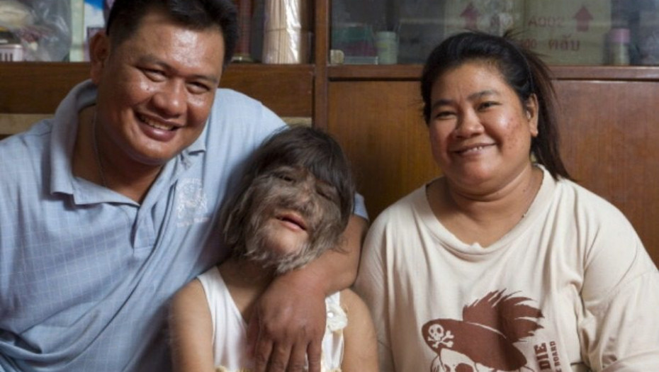 Το κορίτσι λυκάνθρωπος ξυρίστηκε και βρήκε τον έρωτα!