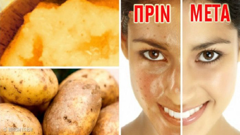 8 ΤΡΟΦΕΣ ΠΟΥ ΚΑΝΟΥΝ ΚΑΛΟ ΣΤΟ ΔΕΡΜΑ ΣΑΣ!