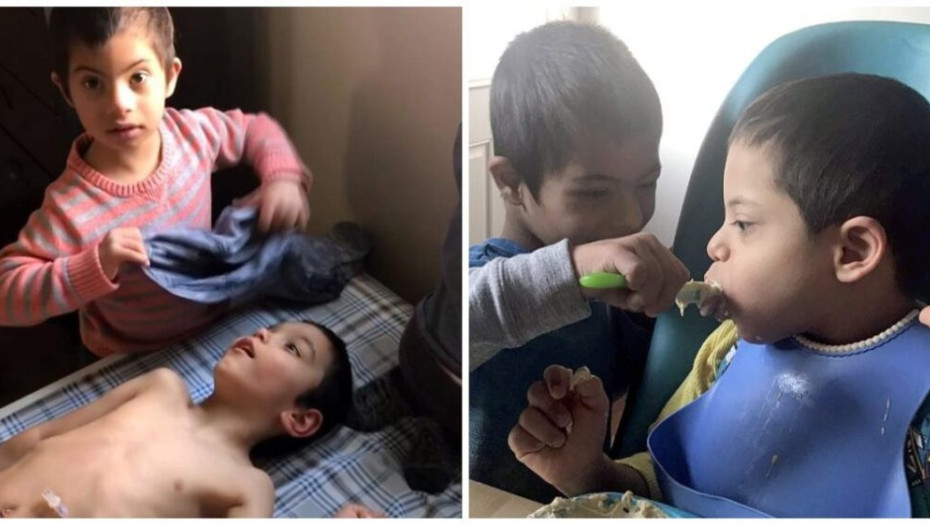 Παιδί 4 ετών με Σύνδρομο Down φροντίζει τα 3 ανάπηρα αδέλφια του και συγκινεί το διαδίκτυο!