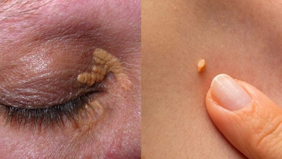 Σημάδια στο δέρμα: 10 “αθώα” συμπτώματα στην επιδερμίδα δείχνουν πως κάτι δεν πάει καλά με την υγεία μας