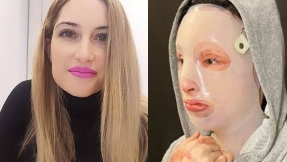 Ιωάννα Παλιοσπύρου: Πετά τη μάσκα και δείχνει το πρόσωπο της – Το πρώτο βίντεο από την κατάθεση ψυχής