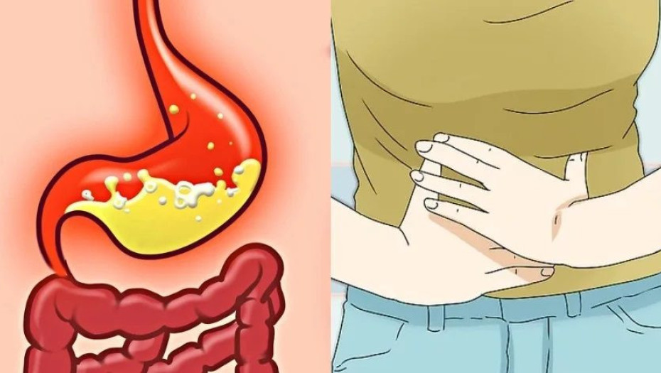 Καούρα στο στομάχι: 8 σοβαρές παθήσεις με τις οποίες συνδέεται – Τι να κάνετε