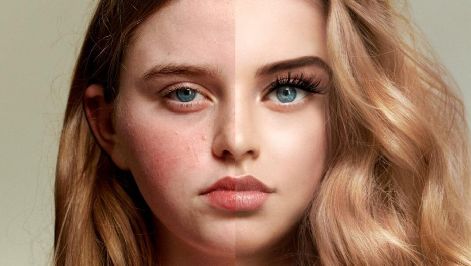 Οι πιέσεις στα μέσα κοινωνικής δικτύωσης οδηγούν τα κορίτσια στη διαστρέβλωση της εμφάνισης τους