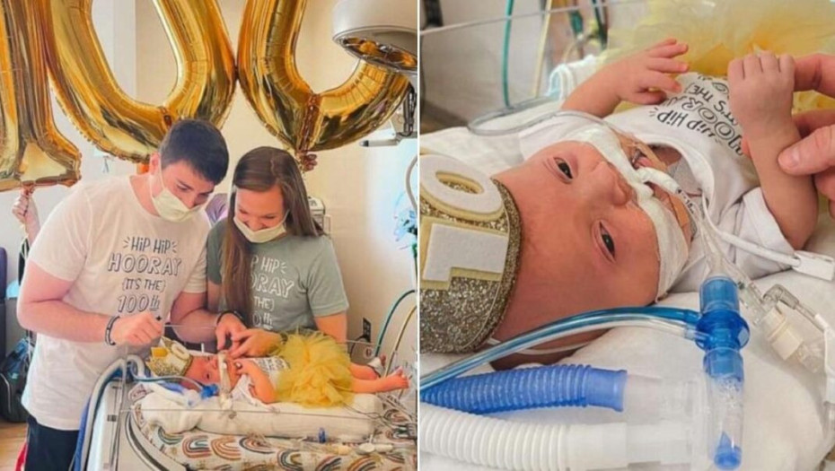 Γονείς γιόρτασαν τις πρώτες 100 μέρες της κόρης τους κάνοντας πάρτι στη… ΜΕΘ νεογνών