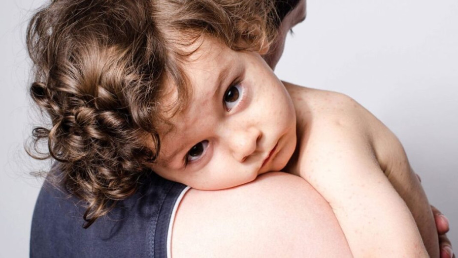 Πιθανές διαταραχές του ύπνου στα παιδιά – Συμπτώματα, διάγνωση και θεραπεία